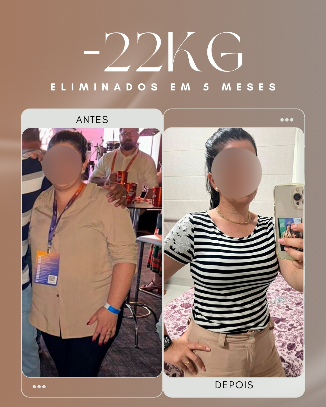 Antes e depois — Emagrecimento